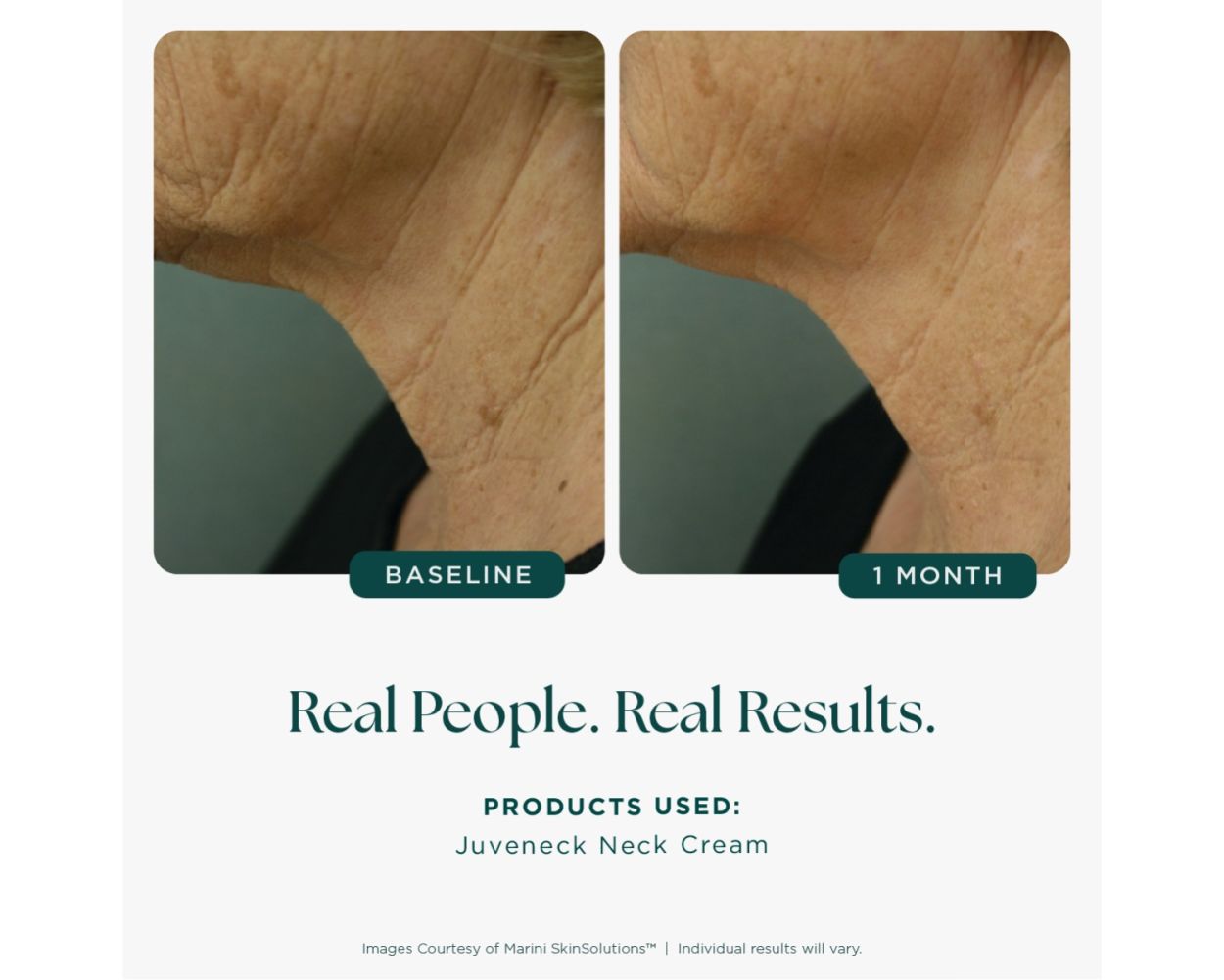 Jan Marini Juveneck® Neck Cream