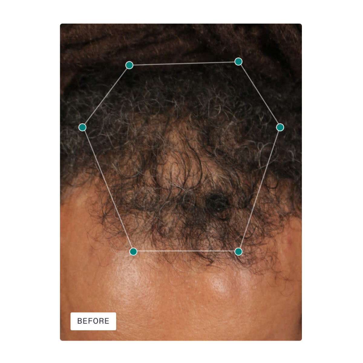 Nutrafol Men’s Hair Growth Supplement – 3 Month Supply