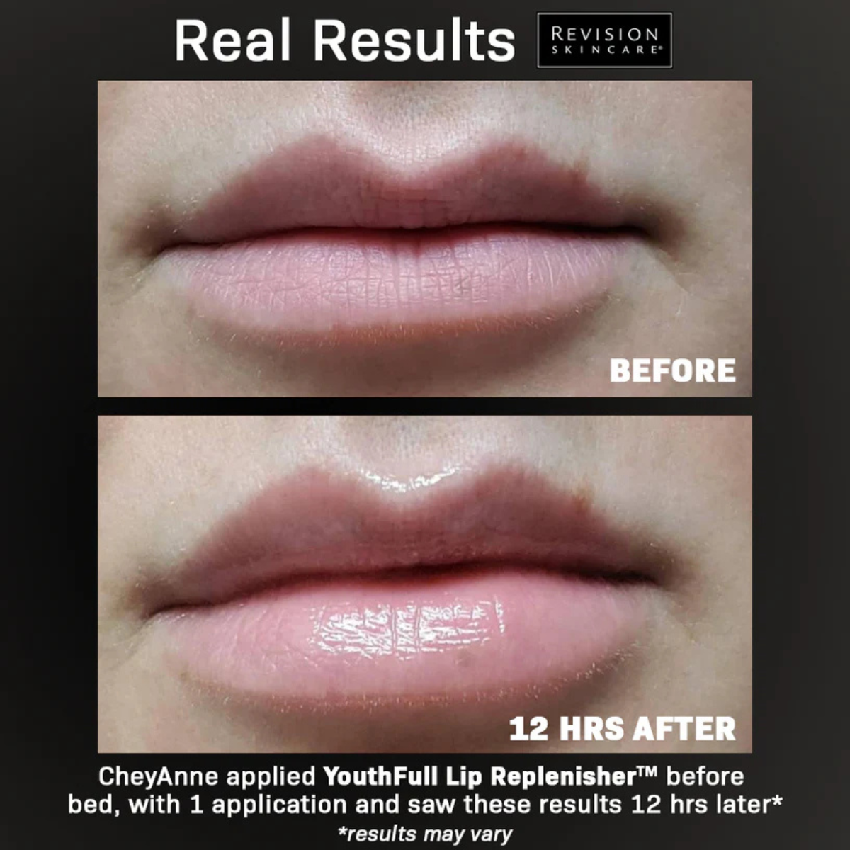 Revision® YouthFull Lip Replenisher®