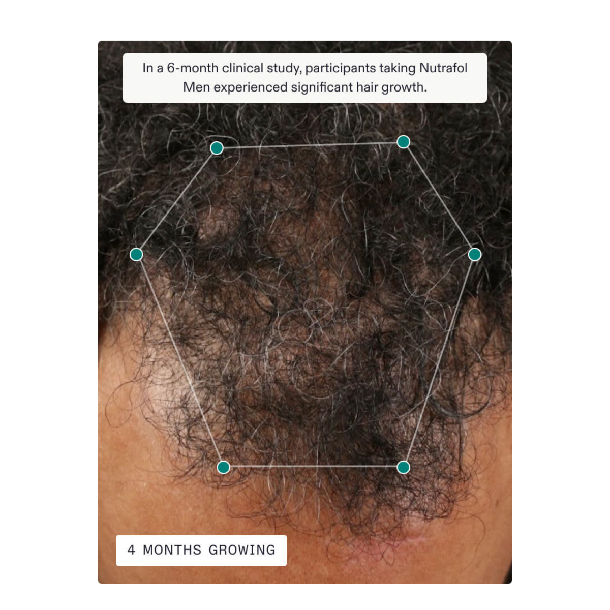 Nutrafol Men’s Hair Growth Supplement – 3 Month Supply