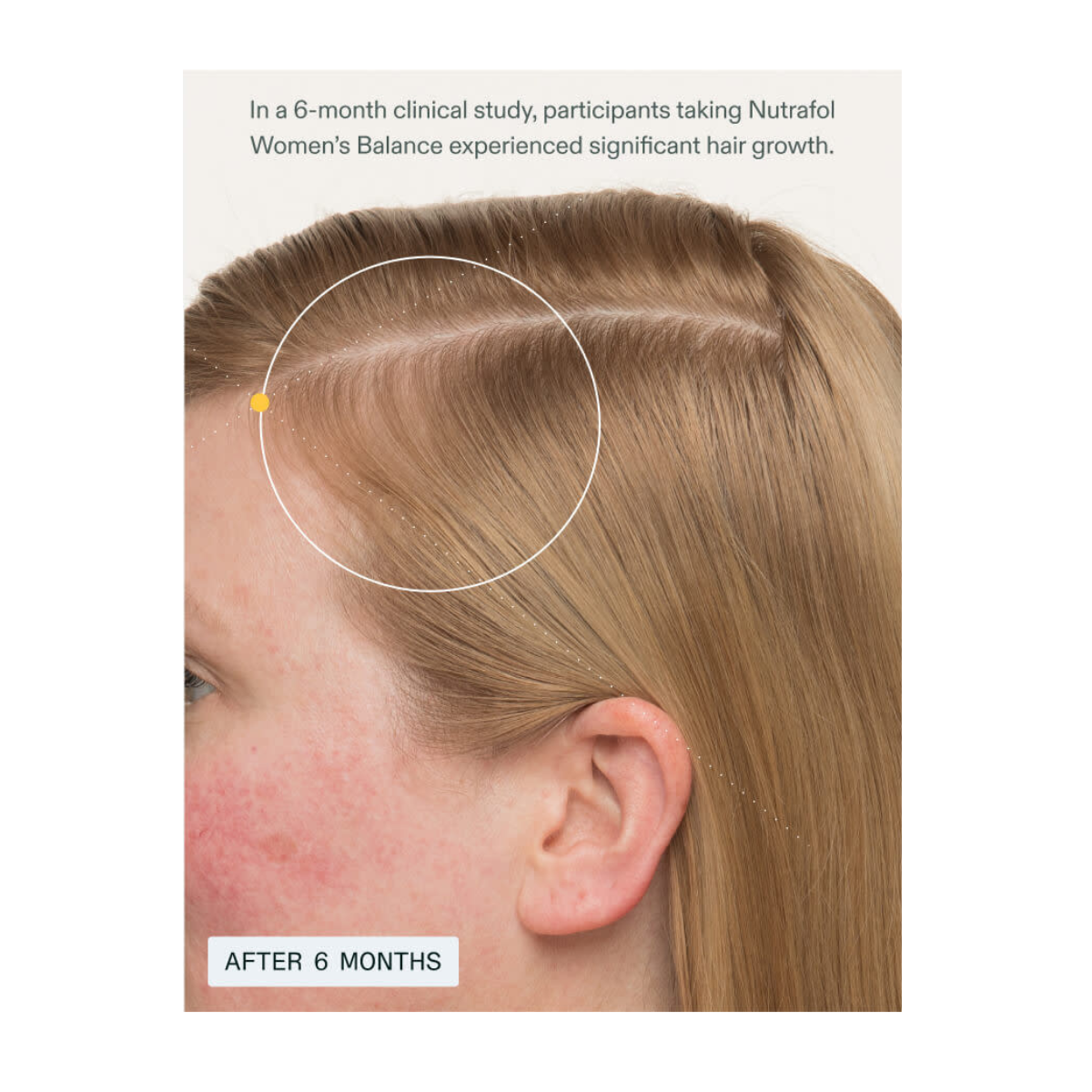 Nutrafol Women’s  Regular Hair Growth Supplement – 3 Month Supply