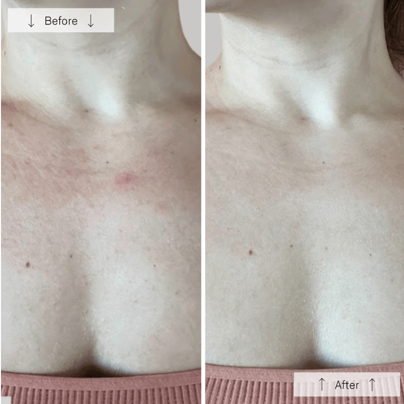 Omnilux Contour NECK & DÉCOLLETÉ – LED Light Therapy Mask