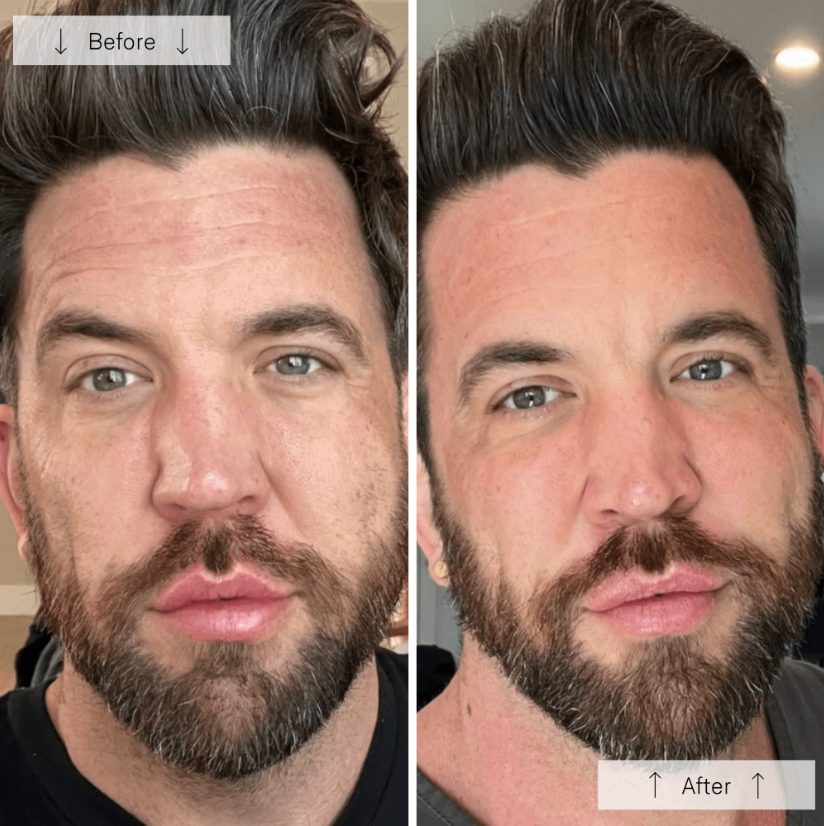 Omnilux Men – LED Light Therapy Mask