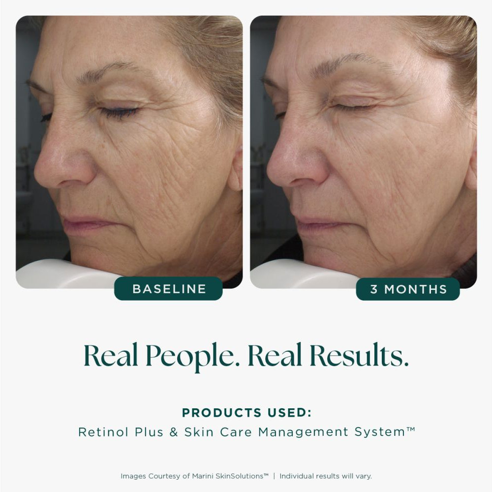 Jan Marini Age Intervention™ Retinol Plus