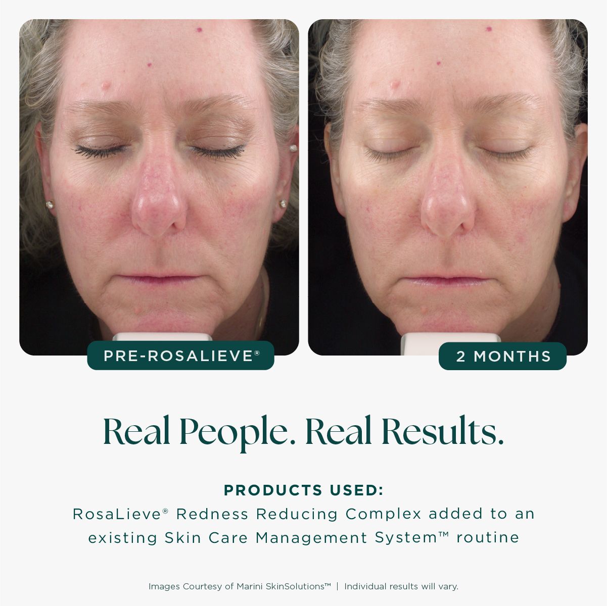 Jan Marini Rosalieve® Redness Reducing Complex